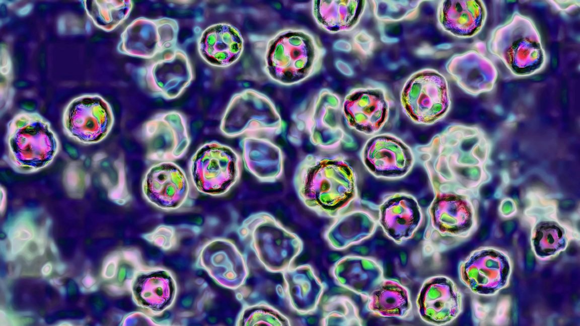 South Carolina’s measles outbreak jumped to Washington state 5 times in 2 weeks